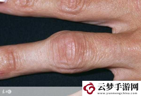 寶寶怎么才三根手指就痛1.寶寶為何三根手指就感到疼痛